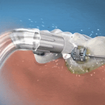 Nuevo Irrigador Bucal | Profesional Electric Efficient MaxPro ® – Dˈ Jhon Store